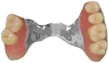 prothèse amovible